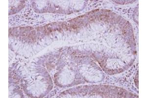 Image no. 1 for anti-Glucose-Fructose Oxidoreductase Domain Containing 2 (GFOD2) (AA 198-385) antibody (ABIN1498450) (GFOD2 抗体  (AA 198-385))