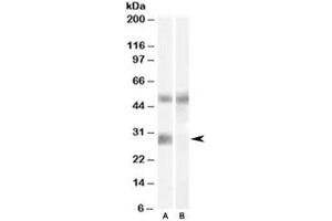 Western blot testing of human breast cancer lysate with IGFBP3 antibody at 0. (IGFBP3 抗体)