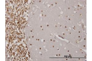 Immunoperoxidase of monoclonal antibody to EN1 on formalin-fixed paraffin-embedded human cerebellum. (EN1 抗体  (AA 266-392))