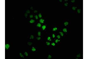 Immunofluorescence staining of Hela cells with ABIN7149505 at 1:200, counter-stained with DAPI.
