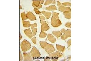 Formalin-fixed and paraffin-embedded human skeletal muscle reacted with EYA4 Antibody (C-term), which was peroxidase-conjugated to the secondary antibody, followed by DAB staining. (EYA4 抗体  (C-Term))