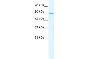 WB Suggested Anti-HCLS1 Antibody Titration:  1. (HCLS1 抗体  (N-Term))
