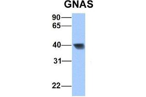 Host:  Rabbit  Target Name:  GNAS  Sample Type:  Human Fetal Heart  Antibody Dilution:  1.