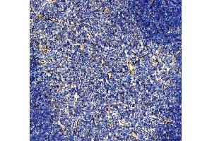 anti-Platelet/endothelial Cell Adhesion Molecule (PECAM1) (AA 58-273) antibody