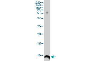 ATOX1 monoclonal antibody (M05), clone 3E1. (ATOX1 抗体  (AA 1-68))