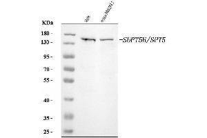 Western blot analysis of SPT5/SUPT5H using anti-SPT5/SUPT5H antibody (ABIN7601985).