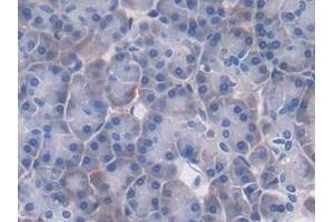 Immunohistochemistry (IHC) image for anti-Protein tyrosine Phosphatase, Receptor Type, B (PTPRB) (AA 1655-1918) antibody (ABIN7439990)