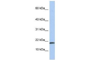 IL1 alpha antibody used at 1 ug/ml to detect target protein. (IL1A 抗体  (N-Term))