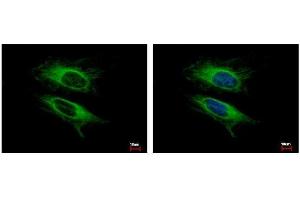 ICC/IF Image VPS11 antibody detects VPS11 protein at cytoplasm by immunofluorescent analysis. (VPS11 抗体  (Center))