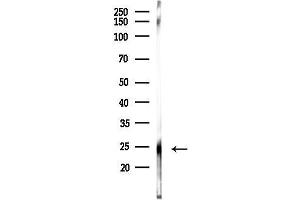 anti-Protein Phosphatase 1, Regulatory (Inhibitor) Subunit 2 (PPP1R2) (N-Term) antibody