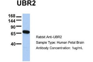 Host:  Rabbit  Target Name:  UBR2  Sample Type:  Human Fetal Brain  Antibody Dilution:  1. (UBR2 抗体  (C-Term))