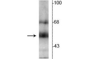 Western blot of hippocampal lysate showing specific immunolabeling of the ~55 kDa TR-β protein. (THRB 抗体  (N-Term))