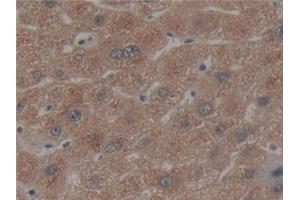 Detection of CX3CL1 in Human Liver Tissue using Polyclonal Antibody to Chemokine C-X3-C-Motif Ligand 1 (CX3CL1) (CX3CL1 抗体  (AA 25-332))