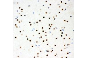 Immunohistochemistry (IHC) image for anti-Ribosomal Protein S6 Kinase, 90kDa, Polypeptide 5 (RPS6KA5) (AA 540-665) antibody (ABIN3043424)