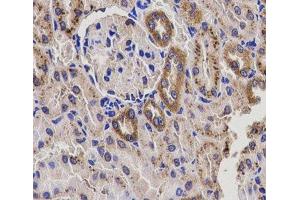 Immunohistochemistry of paraffin-embedded Rat kidney using EPHX2 Polyclonal Antibody at dilution of 1:200 (40x lens). (EPHX2 抗体)