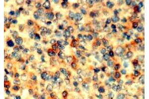 Immunohistochemistry (IHC) image for anti-Abl-Interactor 1 (ABI1) antibody (ABIN1449186) (ABI1 抗体)