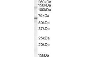 Western Blotting (WB) image for anti-Interleukin-1 Receptor-Associated Kinase 3 (IRAK3) (AA 582-593) antibody (ABIN296287) (IRAK3 抗体  (AA 582-593))