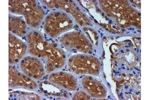 Immunohistochemical staining of paraffin-embedded Human Kidney tissue using anti-PDSS2 mouse monoclonal antibody. (PDSS2 抗体)