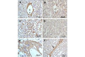 Immunohistochemistry (IHC) image for anti-Collagen, Type III, alpha 1 (COL3A1) antibody (ABIN5596829)