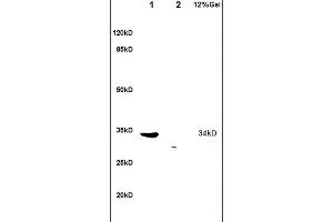 L1 human colon carcinoma lysates L2 rat brain lysates probed with Anti TRADD Polyclonal Antibody, Unconjugated (ABIN673314) at 1:200 overnight at 4 °C. (TRADD 抗体  (AA 111-230))