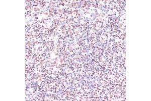 Immunohistochemistry (IHC) image for anti-cAMP Responsive Element Binding Protein 1 (CREB1) (AA 1-341) antibody (ABIN7266053)