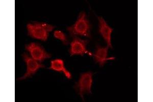 ABIN6276176 staining HeLa by IF/ICC. (OR5W2 抗体  (Internal Region))