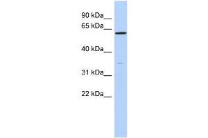 WB Suggested Anti-ZNF431 Antibody Titration:  0. (ZNF431 抗体  (N-Term))