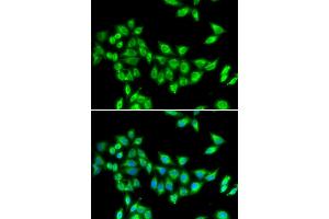 Immunofluorescence analysis of U2OS cells using KIF3A antibody (ABIN5973995). (KIF3A 抗体)