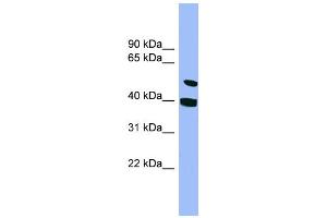 WB Suggested Anti-SMU1 Antibody Titration: 0. (SMU1 抗体  (N-Term))