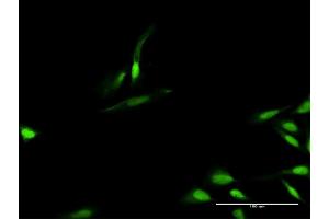 Immunofluorescence of purified MaxPab antibody to TIMELESS on HeLa cell. (TIMELESS 抗体  (AA 1-1208))
