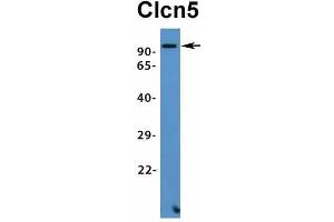 Host:  Rabbit  Target Name:  Clcn5  Sample Type:  Mouse Heart  Antibody Dilution:  1.