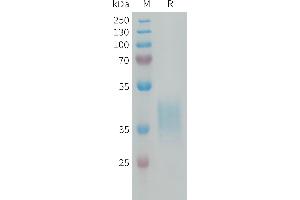 SDS-PAGE (SDS) image for Cytokine Receptor-Like Factor 2 (CRLF2) (AA 23-231) protein (His tag) (ABIN7538213)