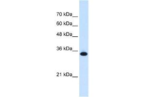 WB Suggested Anti-SLC25A38 Antibody Titration:  0. (SLC25A38 抗体  (Middle Region))