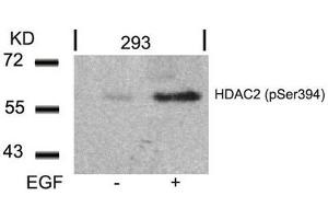 Western blot analysis of extracts from 293 cells untreated or treated with EGF using HDAC2(Phospho-Ser394) Antibody. (HDAC2 抗体  (pSer394))
