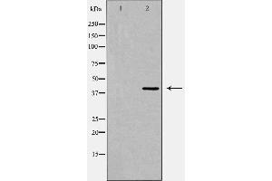 Western blot analysis of PRLHR expression in Jurkat cell extract,The lane on the left is treated with the antigen-specific peptide. (PRLHR 抗体  (Internal Region))