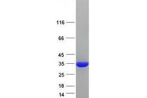 Western Blotting (WB) image for Secretagogin, EF-Hand Calcium Binding Protein (SCGN) protein (Myc-DYKDDDDK Tag) (ABIN2731589)