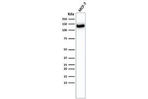 Western Blotting (WB) image for anti-Cadherin 1, Type 1, E-Cadherin (Epithelial) (CDH1) antibody (ABIN5707889)