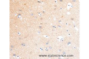 Immunohistochemistry of Human brain using SLC22A17 Polyclonal Antibody at dilution of 1:40