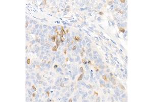 Immunohistochemistry (IHC) image for anti-Chromosome 6 Open Reading Frame 150 (C6orf150) (AA 350-522) antibody (ABIN6143590)