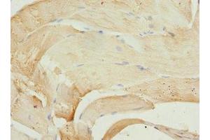 Immunohistochemistry of paraffin-embedded human skeletal muscle tissue using ABIN7163186 at dilution of 1:100 (PIP5K1B 抗体  (AA 190-470))