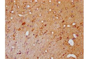 IHC image of ABIN7127722 diluted at 1:100 and staining in paraffin-embedded rat brain tissue performed on a Leica BondTM system. (Recombinant PAK1 抗体  (pSer139, pSer141, pSer144))