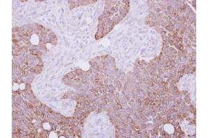 IHC-P Image Cytokeratin 15 antibody detects KRT15 protein at cytosol and membrane on HSC-3 xenograft by immunohistochemical analysis. (KRT15 抗体)