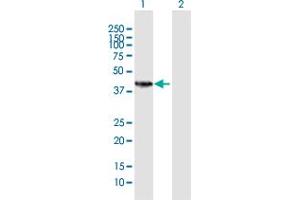 Western Blot analysis of HSD11B2 expression in transfected 293T cell line by HSD11B2 MaxPab polyclonal antibody. (HSD11B2 抗体  (AA 1-405))