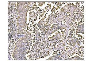 IHC analysis of HCCS using anti-HCCS antibody (ABIN7602424).
