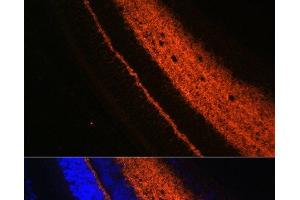 Immunofluorescence analysis of Rat eye using SYT1 Polyclonal Antibody at dilution of 1:100 (40x lens). (SYT1 抗体)