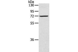 Western Blot analysis of TM4 cell using LTA4H Polyclonal Antibody at dilution of 1:300 (LTA4H 抗体)