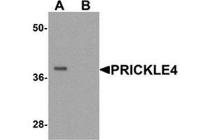 Western blot analysis of PRICKLE4 in A549 cell lysate with PRICKLE4 Antibody  at 0. (PRICKLE4 抗体  (N-Term))