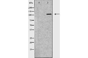 Western blot analysis of NCI-H460  lysate using TLR8 antibody. (TLR8 抗体  (C-Term))