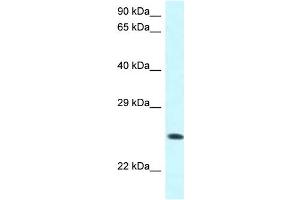 WB Suggested Anti-WWOX Antibody Titration: 1. (WWOX 抗体  (C-Term))
