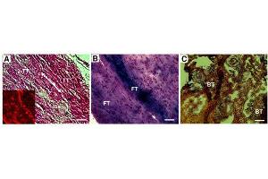 Immunohistochemistry (IHC) image for anti-Collagen, Type I (COL1) antibody (ABIN5596819)